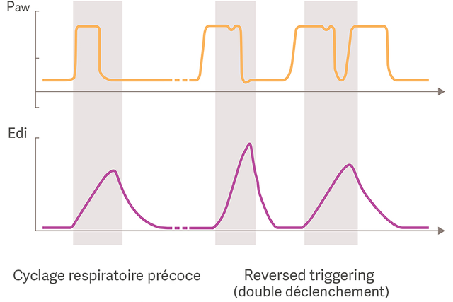Cyclage respiratoire précoce