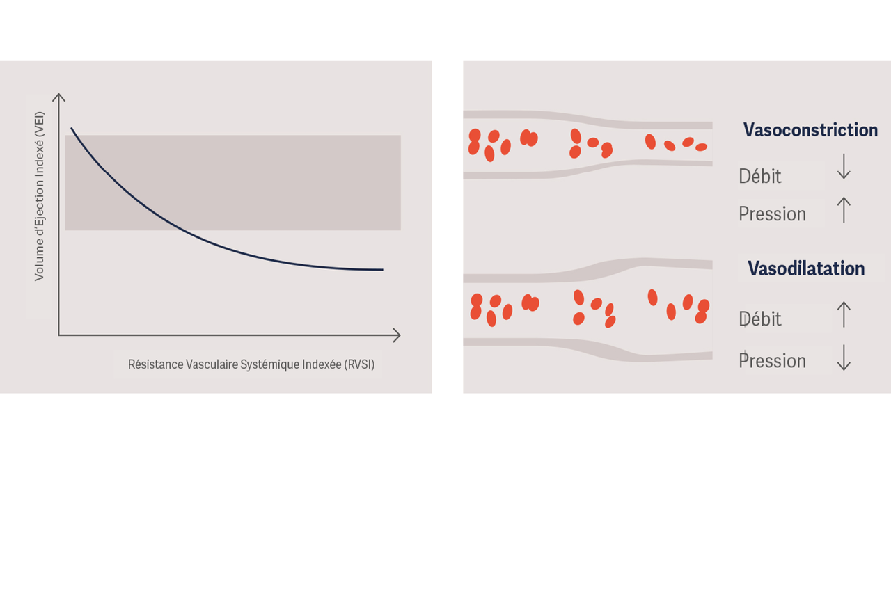 Graphique montrant la tendance descendante de l'evolution du volume d'éjection indexé en fonction du résistance vasculaire systémique indexée