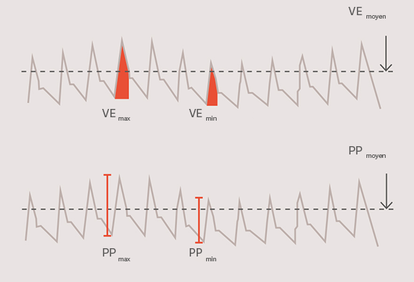 Graphique montrant deux ensembles de variabilité de la fréquence cardiaque avec des points maximum et minimum marqués en rouge pour VE et PP.