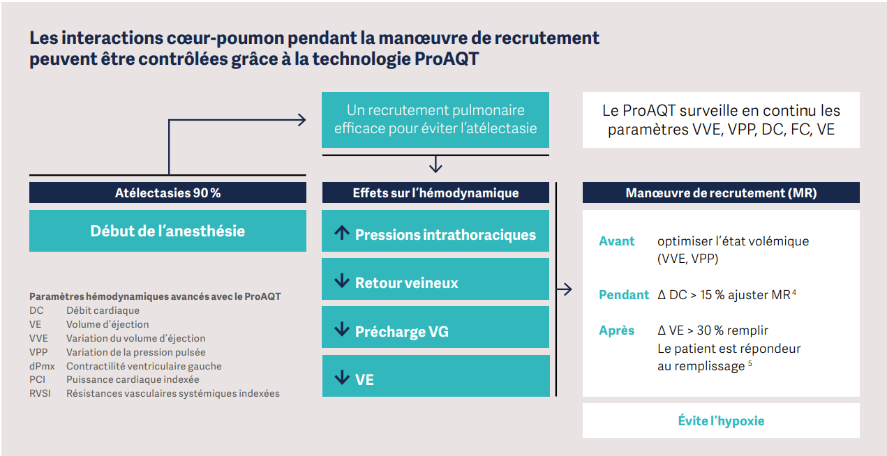 Infographie expliquant l'influence de la technologie ProAQT sur les interactions cœur-poumons lors des manœuvres de recrutement en anesthésie.
