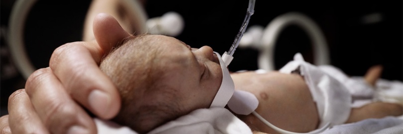 Een te vroeg geboren baby met een beademingsbuisje in een couveuse wordt voorzichtig aangeraakt door de hand van een volwassene.