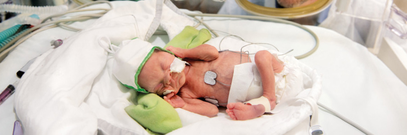NAVA in NICU