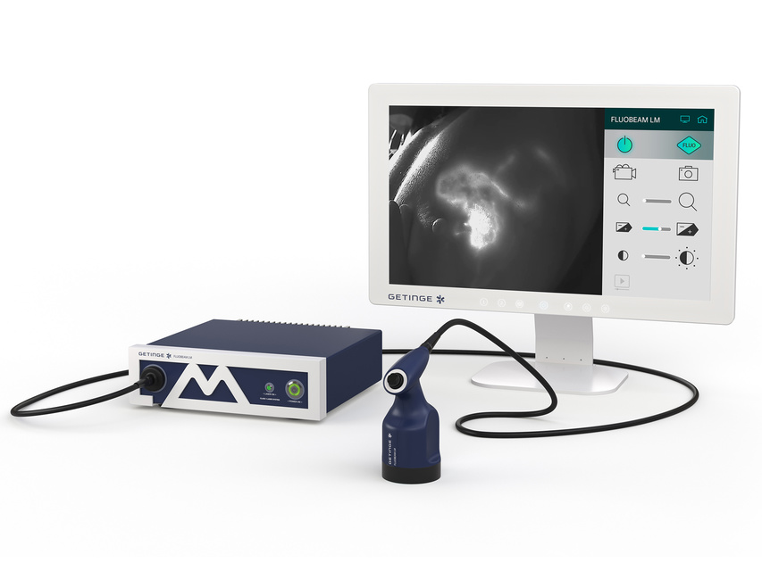 Medical imaging device with a monitor displaying a black-and-white scan, connected to a control unit and camera.