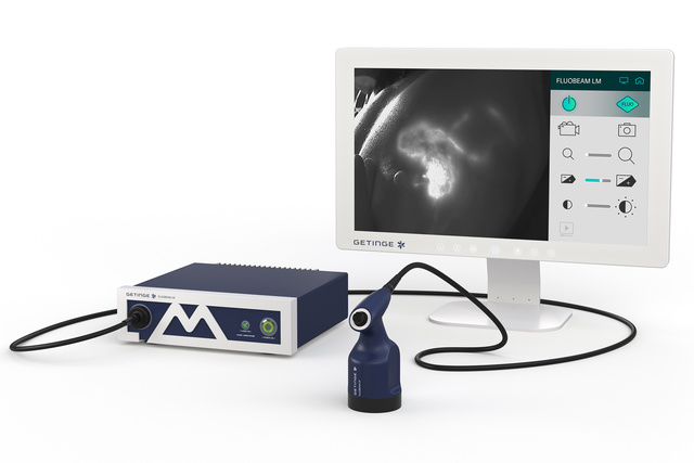Medical imaging device with a monitor displaying a black-and-white scan, connected to a control unit and camera.