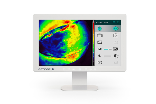 Medical monitor displaying a colorful thermal image with a control panel on the right side.