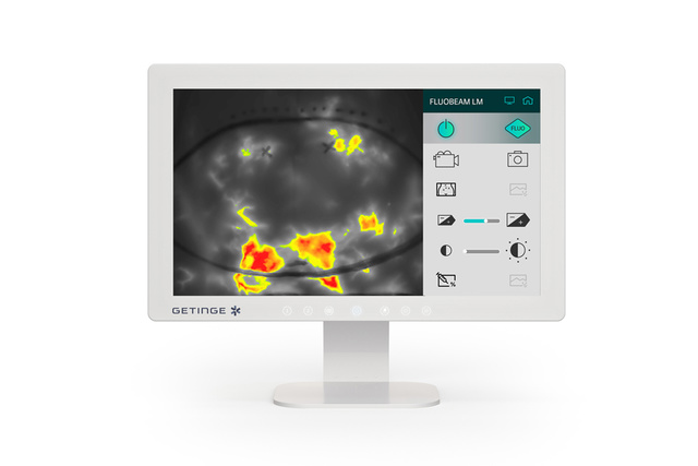 Medical imaging monitor displaying a grayscale scan with highlighted areas in red and yellow, featuring various icons.