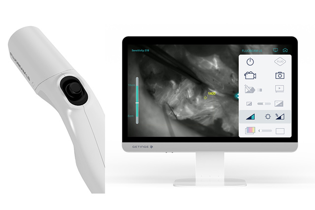  A close-up of the Fluobeam fluorescence imaging camera by ww5, with a focus on the software interface