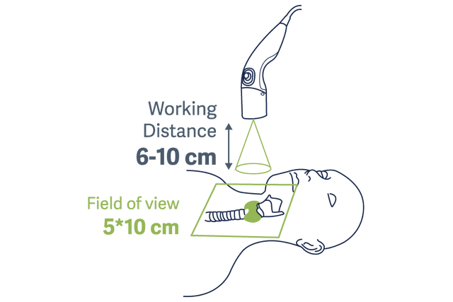  Diagram showing Fluobeam fluorescence imaging during thyroid surgery, illustrating working distance and field of view for intraoperative visualization.