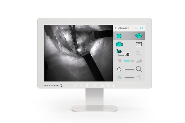 Medical monitor displaying a surgical procedure with control icons on the side.