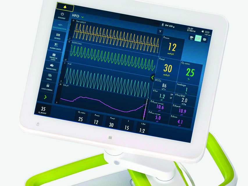 ww5 Servo-n mechanical ventilator screen showing HFOV High Frequency Oscillatory Ventilation ventilation mode