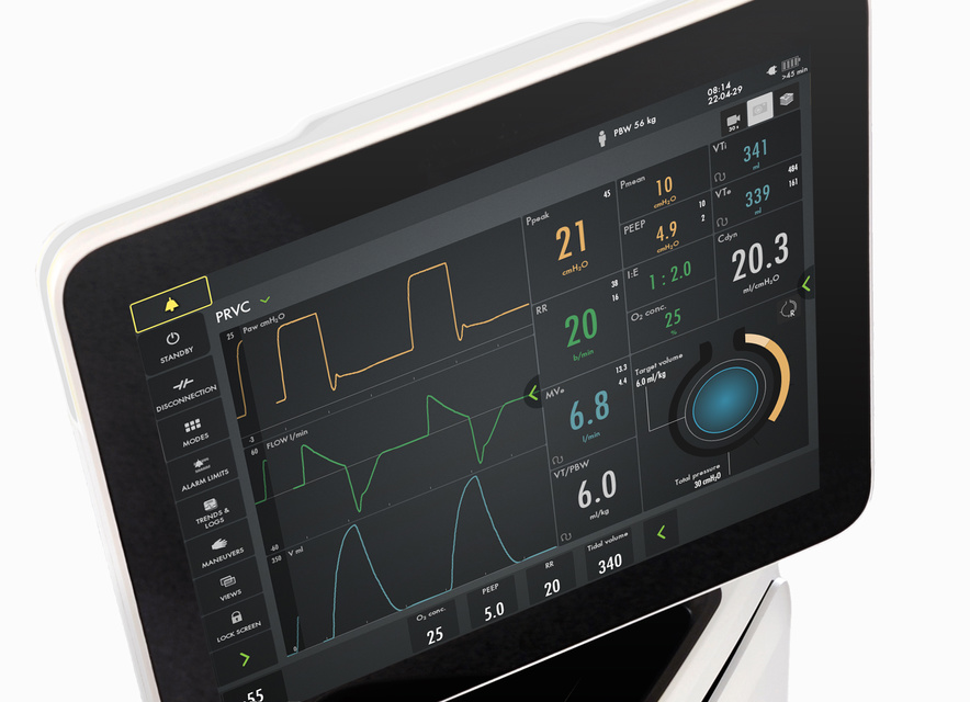 Servo-u ventilator