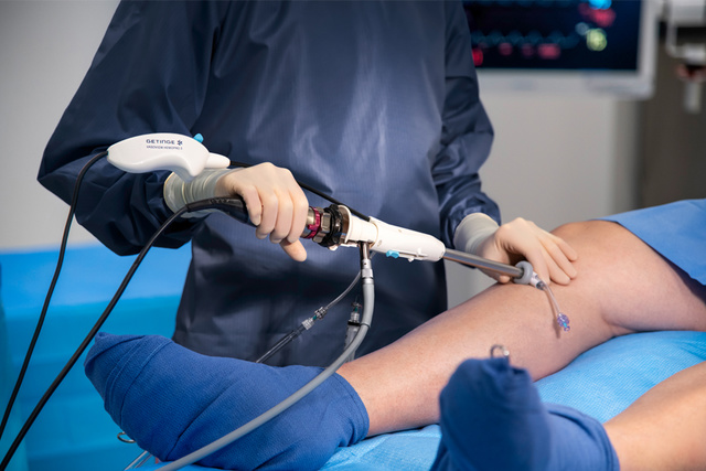 ww5 Vasoview Hemopro 3 Endoscopic Vessel Harvesting System radial