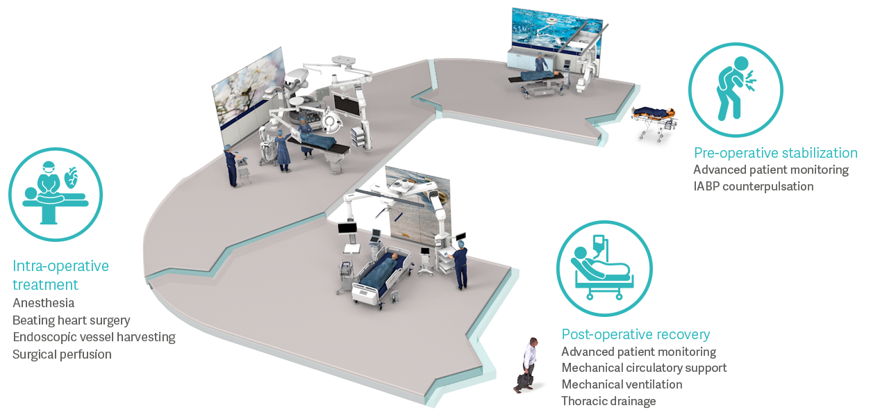 Coronary artery bypass grafting patient flow 