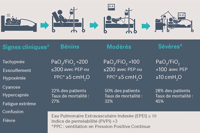 Infographie montrant les signes et les symptômes cliniques du SDRA, classés comme légers, modérés et sévères. .