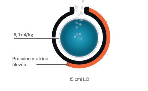 Coupe transversale d'un récipient sphérique montrant une pression de l'élément central à 6,0 ml par kg, et en superficie une pression motrice élevée à 15 cmH₂O. .