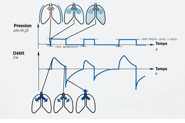 Diagramme montrant la pression pulmonaire et les schémas de flux d'air au fil du temps, avec des illustrations de poumons à différentes phases.
