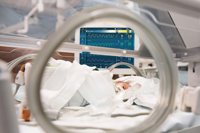 Neonate in incubator with ww5 Servo-n mechanical ventilator screen seen in the background 