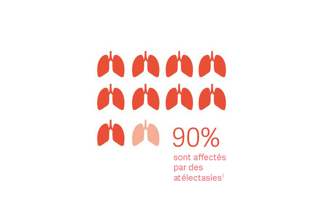 Illustration de neuf icônes de poumons rouges et d'une icône de poumon rouge en transparence avec un texte indiquant que 90% sont affectés par des atélectasies .
